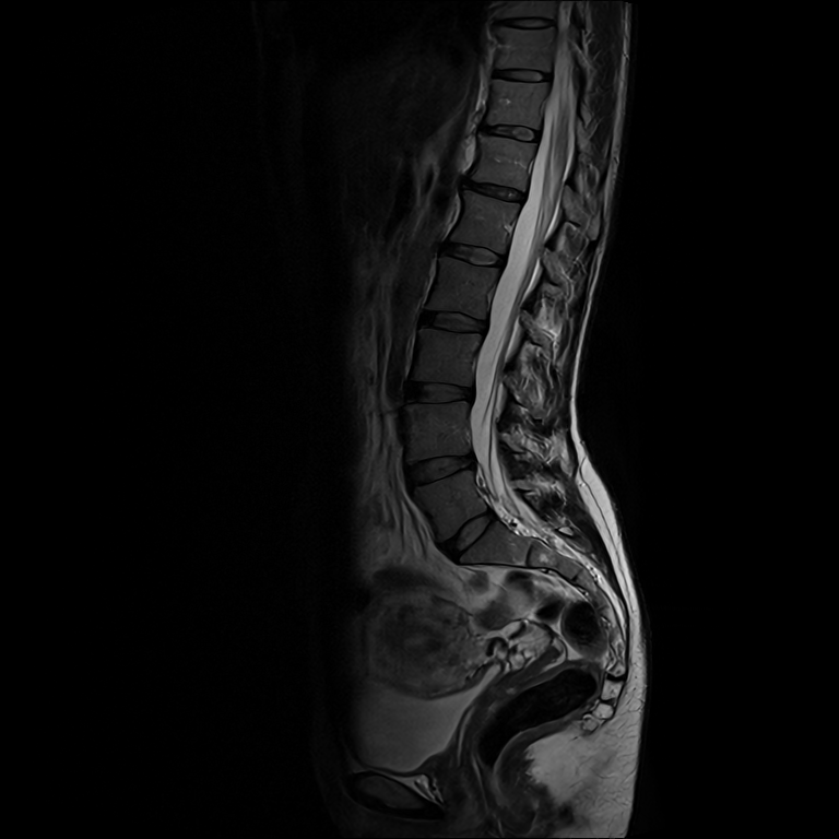 Medical Imaging (DICOM)